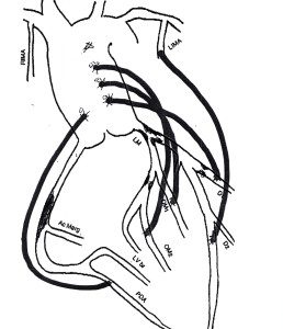 bypass diagram